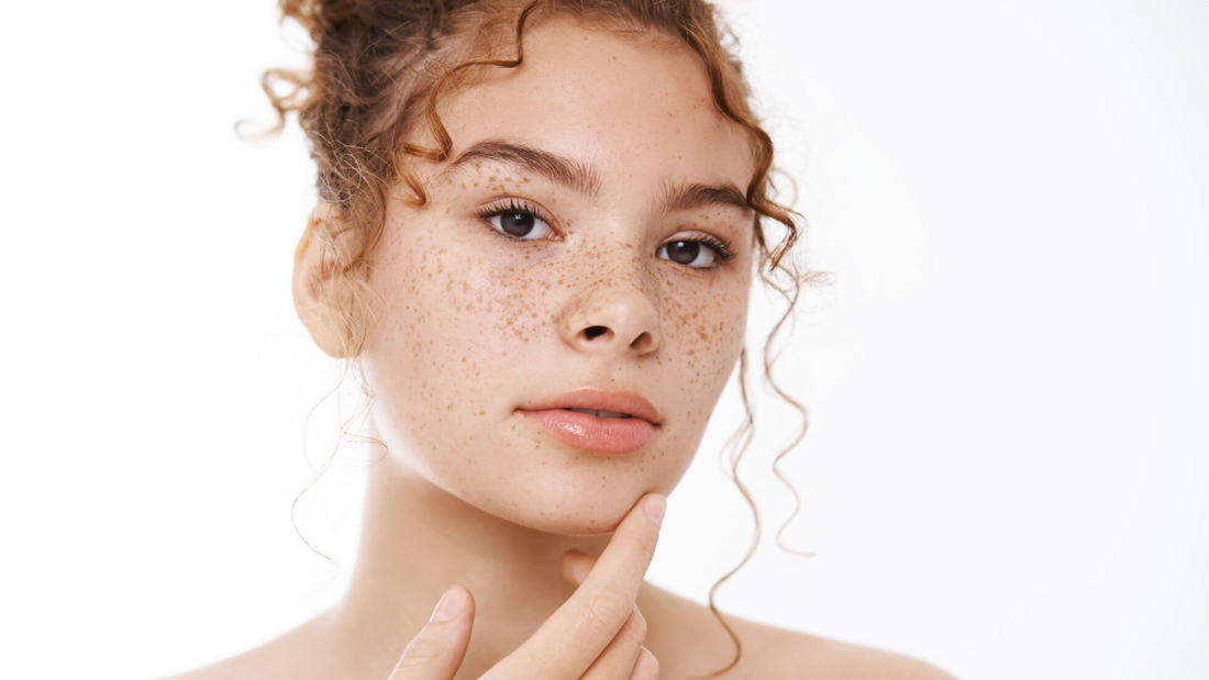 Tackling Dark Spots with the Hyperpigmentation Set